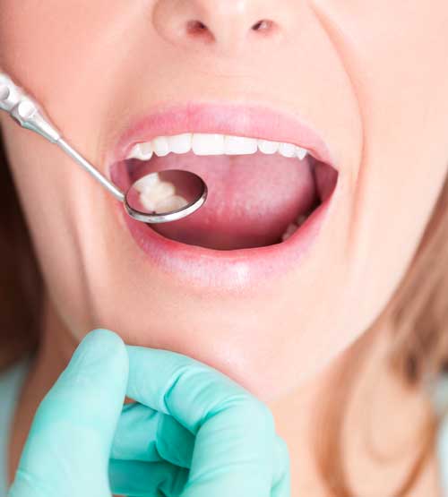 Open mouth dental exam woman