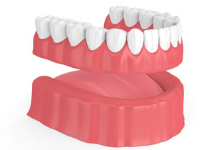 Complete Dentures Lower