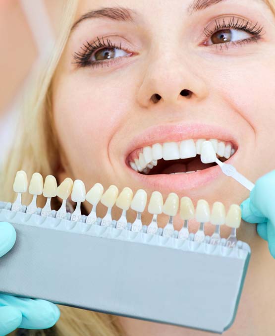 Tooth shade matching for cosmetic bonding